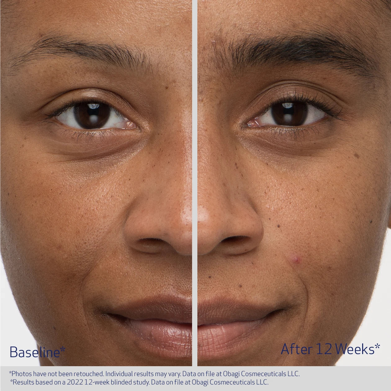 EYEBROW BOOSTING SERUM - Image 2