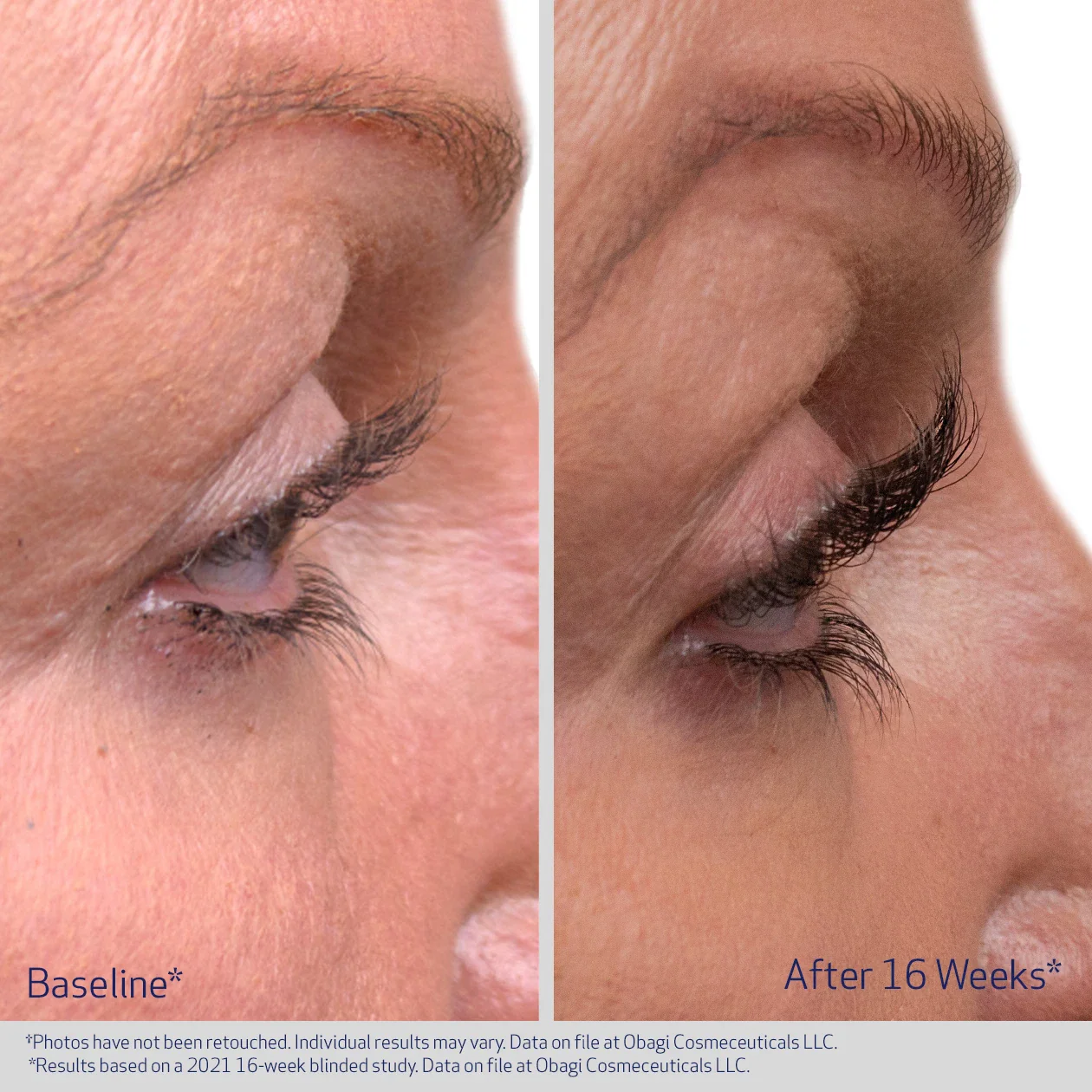 EYELASH ENHANCING SERUM - Image 2