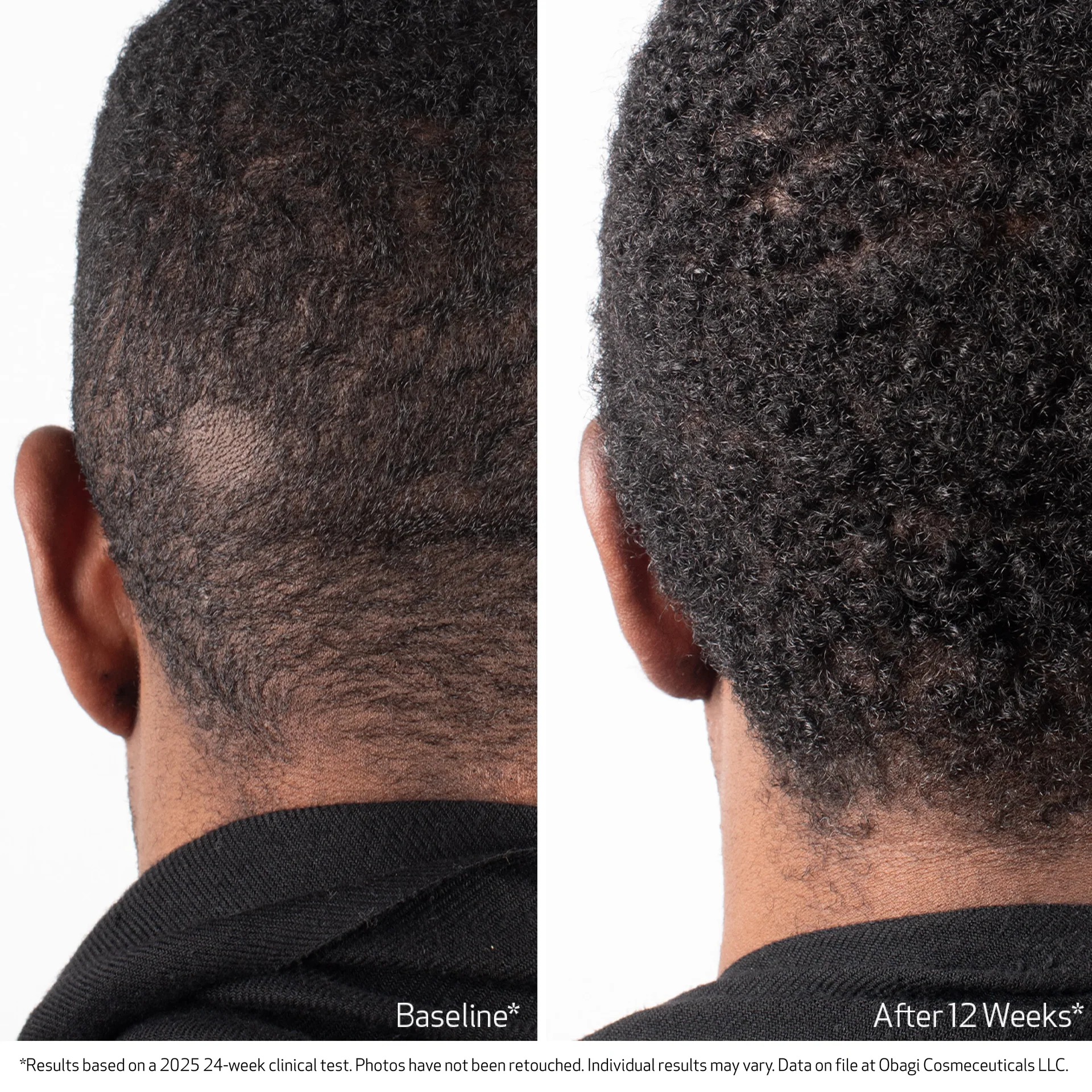 BIOSTIM™ SCALP SERUM - Image 6